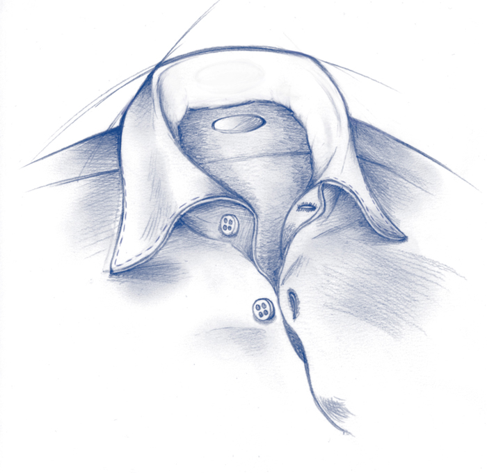 Type-collocamicia1B